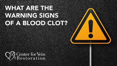 Learn About Blood Clots Center For Vein Restoration