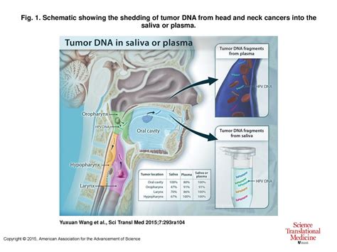 Fig 1 Schematic Showing The Shedding Of Tumor Dna From Head And Neck