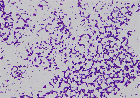 Staphylococcus Epidermidis Negative Stain