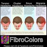 Pictures of Sinus Migraine Natural Treatment