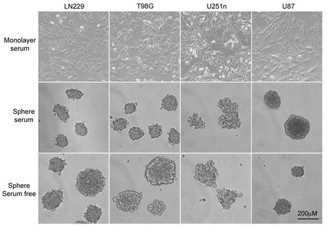Glioblastoma Cell Line Derived Spheres In Serum‑containing Medium
