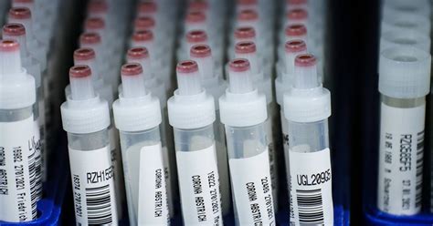 Infection by hepatitis delta virus (hdv) which can only replicate in the presence of hepatitis b virus (hbv) is a cause of significant morbidity and mortality worldwide. Corona Deutschland: Virus-Variante Delta breitet sich ...