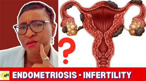 Why Getting Pregnant🤰🏾is So Hard With Endometriosis 😩 Tips Doctors Know Youtube