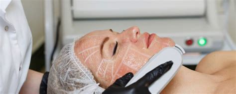 Active Acne Therapy By Wirral Laser Room