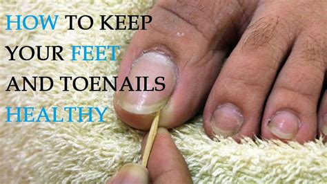 5 Ways To Keep Your Toenails Healthy Anonymous Wire