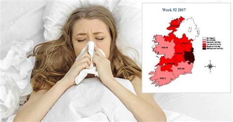 Aussie Flu Red Zone Map Reveals Deadly Influenza Virus Has Spread To Every Part Of Ireland