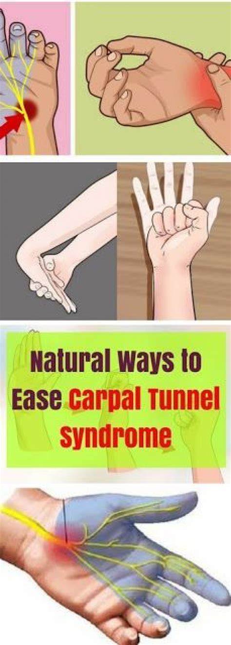 Natural Ways To Ease Carpal Tunnel Syndrome Jointpainrelief In 2020