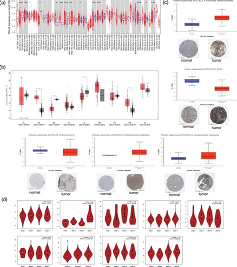 A Pan Cancer Analysis Of The Oncogenic Role Of Procollagen C Medicine