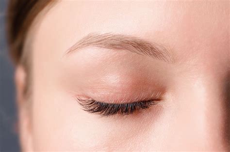 Most Cases Of Eyelid Eczema Can Be Characterized By Itching Stinging