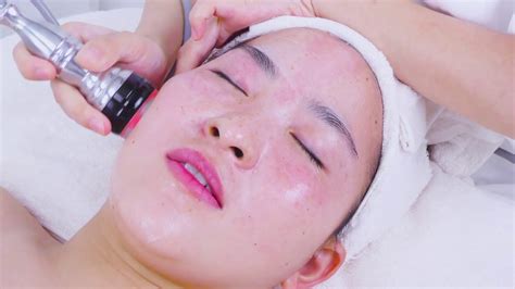 Rf Facial Treatment Rf Radio Frequency Skin Tightening Mychway