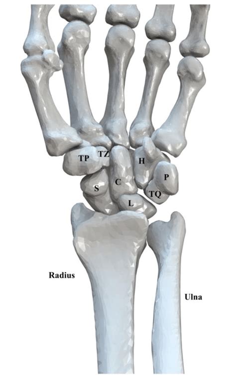 4 Carpal Bones Volar View Of The Bony Anatomy Of The Left Wrist