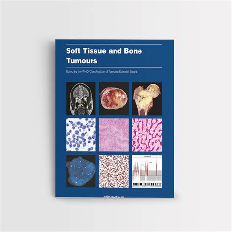 Soft Tissue And Bone Tumours Who Classification Of Tumours Fifth