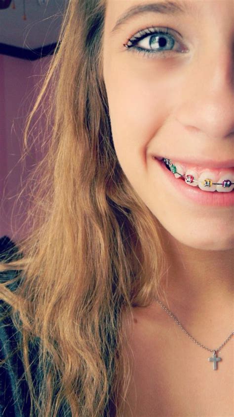 Pin by MoonČhiłd on Handsome Beautiful with Braces