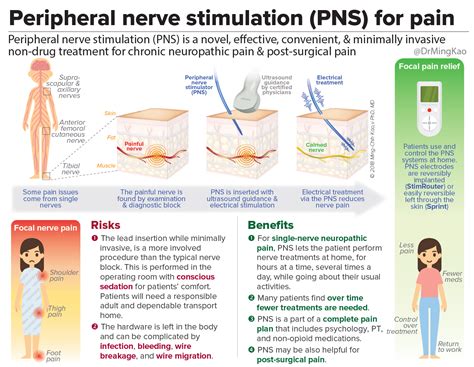 Peripheral Nerve Stimulation Pns For Chronic Pain And Post Surgical