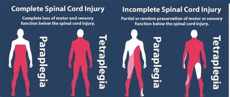 Chapter 26 Spinal Cord Injury Flashcards Quizlet