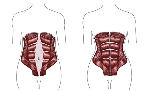 Fixing Diastasis Recti Post Pregnancy Belly In Minutes Of Daily Exercise Shots Health