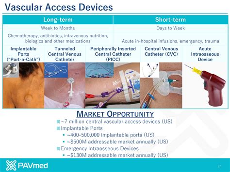 16 Portio Implantable Intraosseous Vascular Access Devices