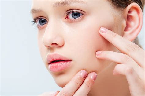Common Skin Problems Faced By Teenagers Pricescope