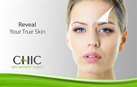 Chemical Peels Chic Med Aesthetic Clinics
