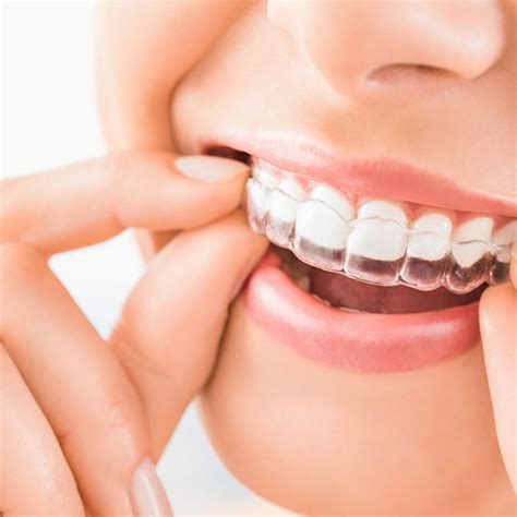invisalign invisible braces apex dental care