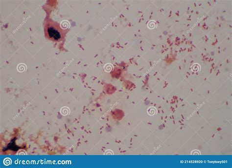 Gram Neagtive Rod In Urine Sample Stock Photo Image Of Infection