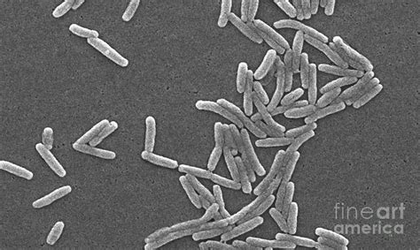 Legionella Pneumophila Photograph By Science Source Pixels