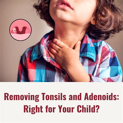Removing Tonsils And Adenoids Right For Your Child