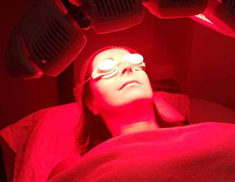 Rimedi per il melasma: il nuovo trattamento luce rossa ...