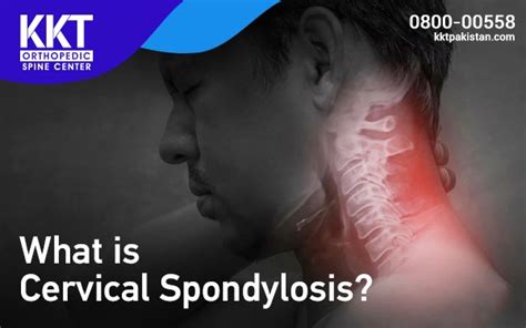 Cervical Spondylosis Symptoms And Causes Kkt Pakistan
