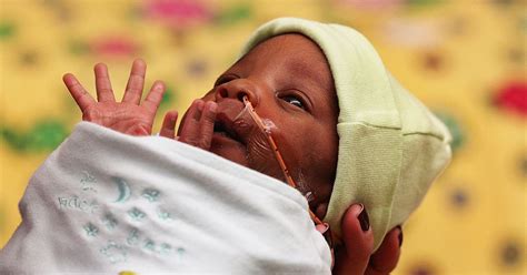 Black Infants In Nicus Receive Different Quality Treatment According