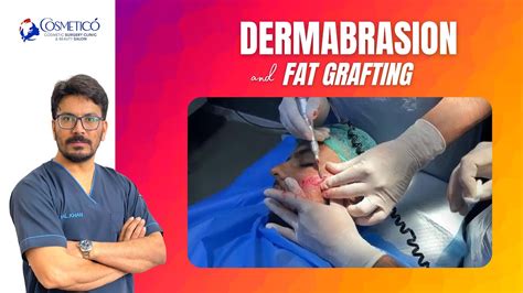 Dermabrasion Scar Removal Treatment Dr Kamal Uddin Khan Cosmetico
