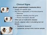 Clinical Signs Of Leukemia Photos