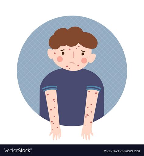 Boy With A Rash On Body Chickenpox Measles Vector Image