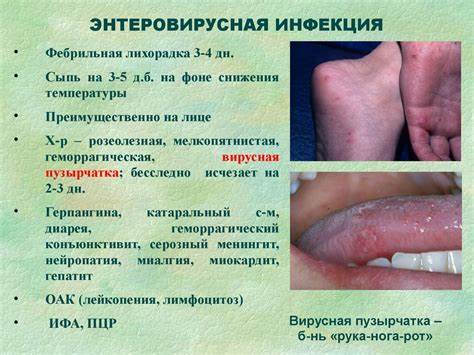Диета при энтеровирусная инфекция Дифференциальный диагноз заболеваний, сопровождающихся синдромом Дифференциальный диагноз заболеваний, сопровождающихся синдромом Диета при энтеровирусная инфекция