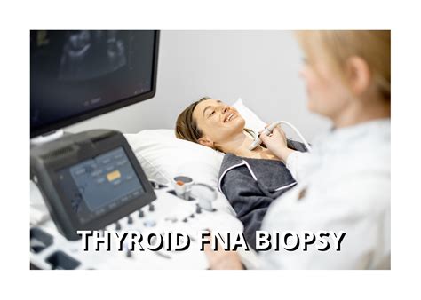 Thyroid Nodule Fna Biopsy District Endocrine