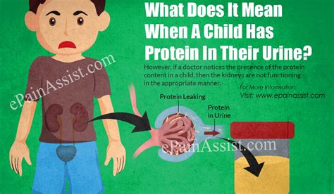 Urinary protein excretion in healthy persons varies considerably and may reach proteinuric levels under several circumstances. What Does It Mean When A Child Has Protein In Their Urine?