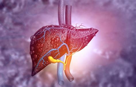What Are The 4 Stages Of Liver Disease 2023 Purehealth Research