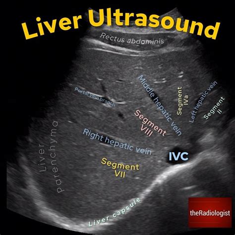 Liver Ultrasound⁣ ⁣ 👨🏽‍💻ultrasound Of The Liver Is A Key Tool In