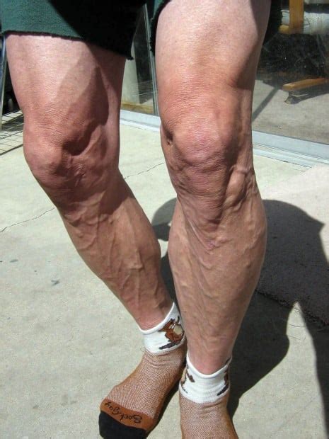 Bald Legged And Beautiful Men Who Shave Their Legs In The Name Of Sport Health Med Fit