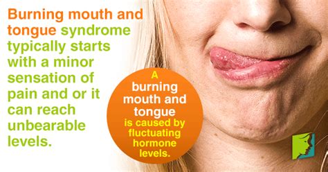 Burning Mouth And Tongue Menopause Now