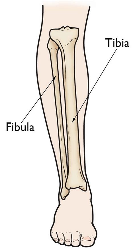 Fibular Hemimelia Causes Signs Symptoms Diagnosis And Treatment