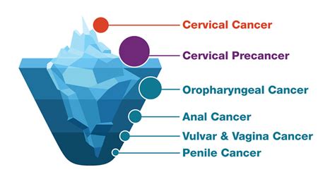 Hpv Cancers Are Preventable Cdc