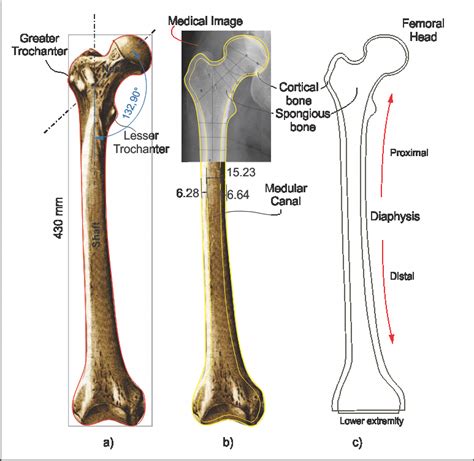 Femoral Bone Anatomy Medical Image And Geometrical Modeling Spline