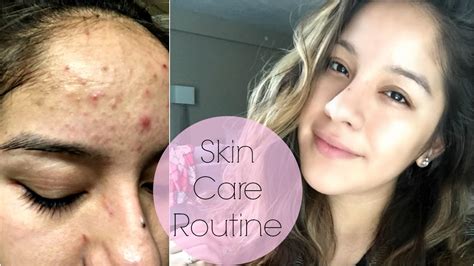 Skin Care Routine How To Clear Skin In 1 Week Youtube