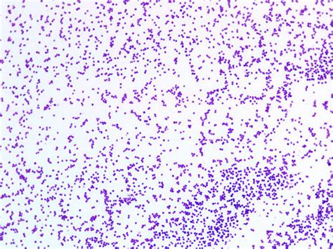 Staphylococcus Aureus Morphology Visualised Using Gram Staining