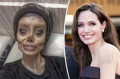 Extreme Plastic Surgery Woman Has Operations To Look Like Angelina