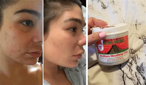 Products With Dramatic Before And After Photos That Are So Satisfying