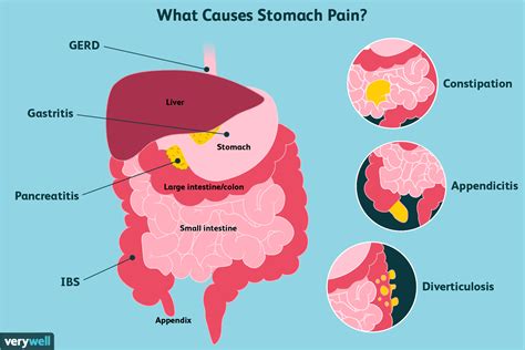 Stomach Pain Causes Treatment And When To See A Healthcare Provider