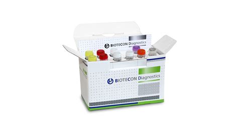 Toolkit for outbreak response and investigation. foodproof® Norovirus Detection Kit - Product - LABVOLUTION ...