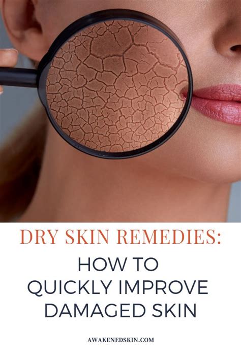 Dry Skin Remedies How To Quickly Improve Damaged Skin Dry Skin